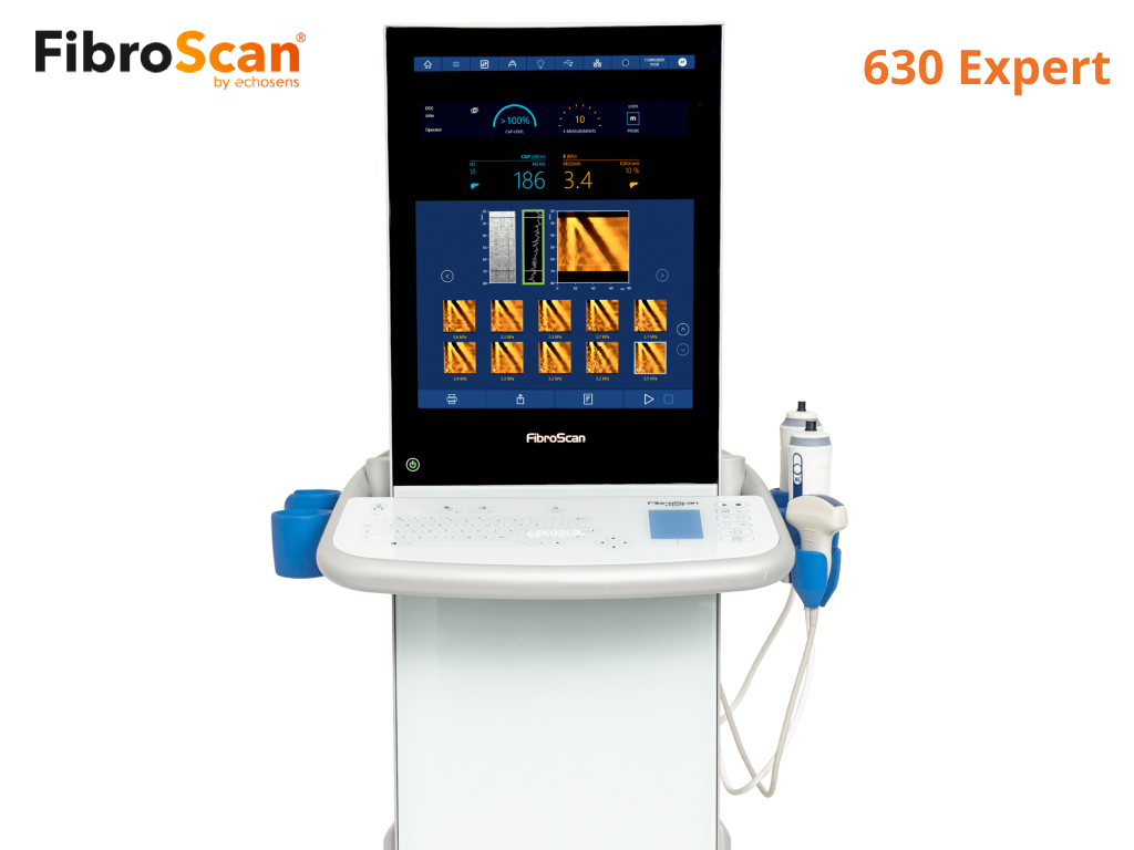 Fibroscan 630 Expert