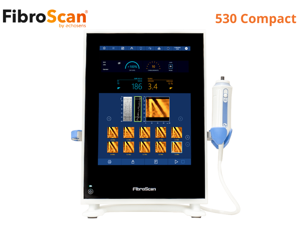 Fibroscan Compact 530