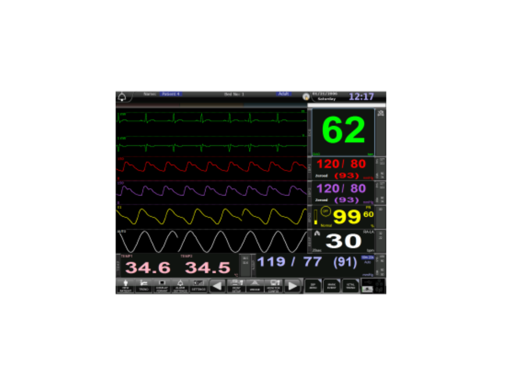 Patient Monitor STAR-90 Modular Multi Parameter Skanray