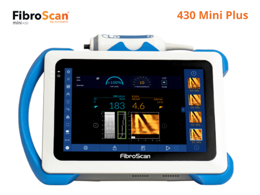 Fibroscan Compact 530